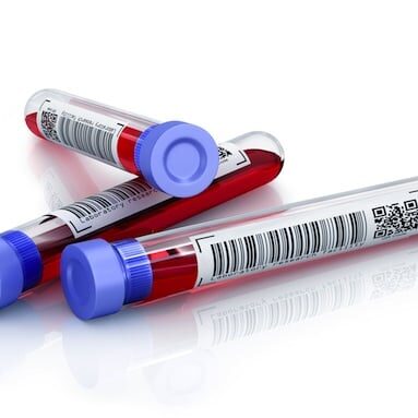 Medical test tubes with blood in holder on white background