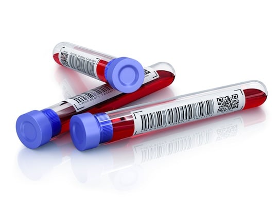 Medical test tubes with blood in holder on white background