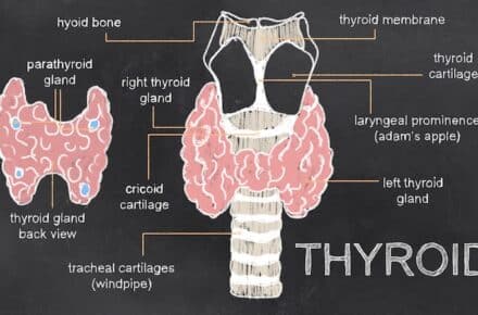 Hashimoto’s Thyroiditis