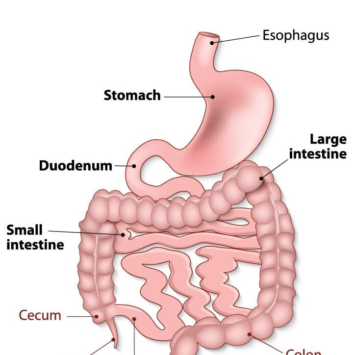 Understanding Small Intestinal Bacterial Overgrowth (SIBO)