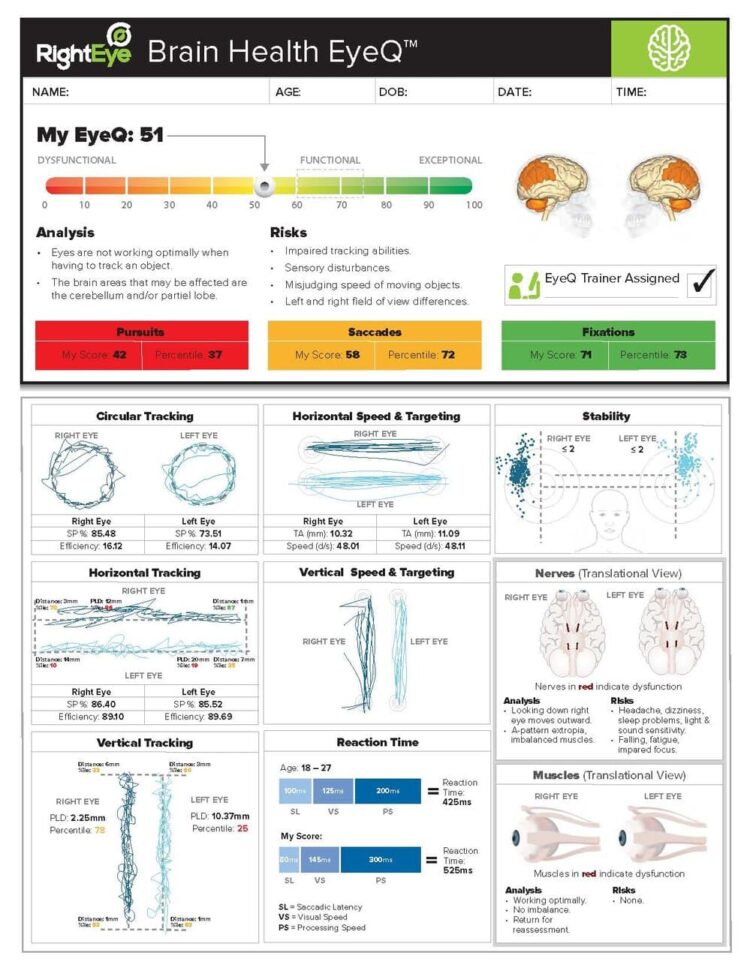 Using Right Eye to Determine Brain Health