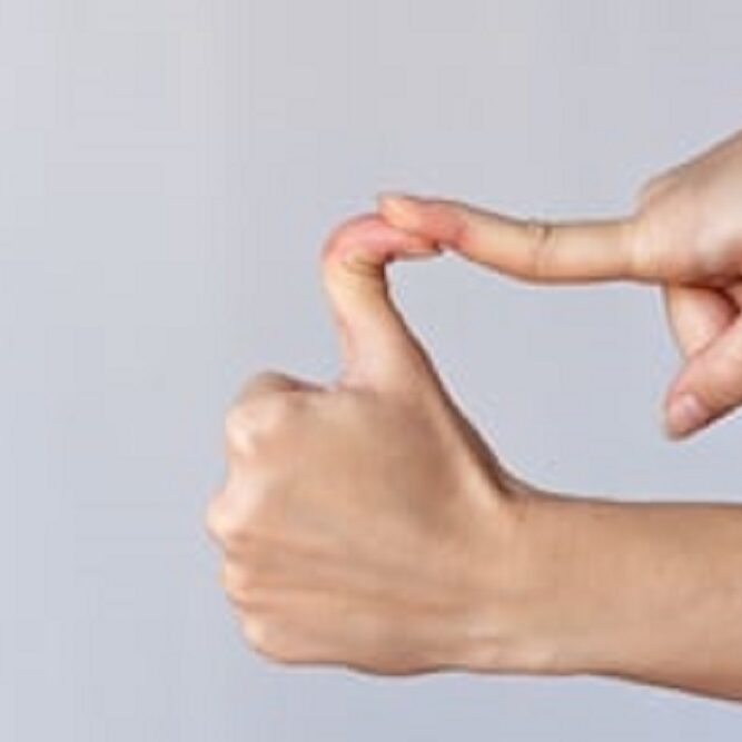 Hypermobile Ehlers-Danlos Syndrome - EDS Symptoms