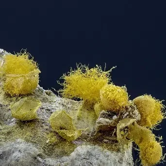 Understanding Mast Cell Activation Syndrome (MCAS)