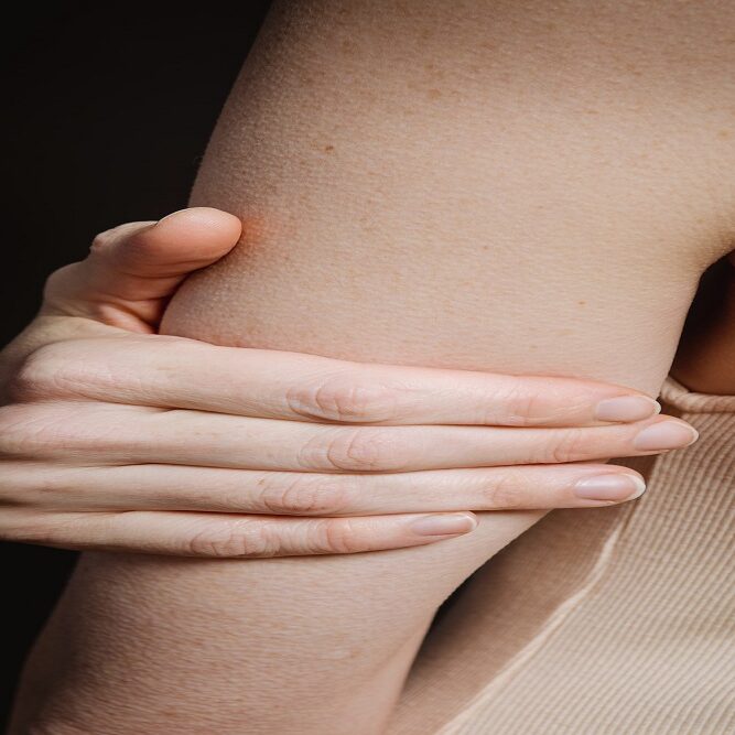 Integrative Treatments for Mast Cell Integrative Treatments for Mast Cell